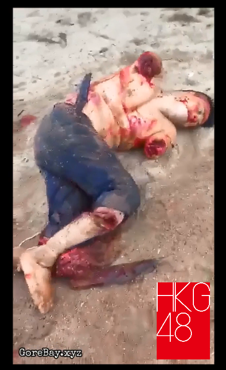 Mexican Man With No Arms And Legs Hkg48 Livegore Com Mexican Man With No Arms And Legs Hkg48 Livegore Com