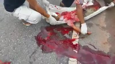 Child Warning! Kid dead due to accident in Vietnam - LiveGore.com 